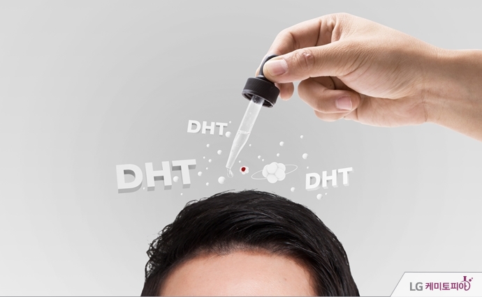 머리카락에 DHT 호르몬이 더해지는 그래픽 이미지
